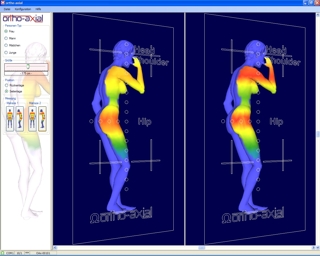 Woman - lateral position