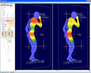 Man - lateral position